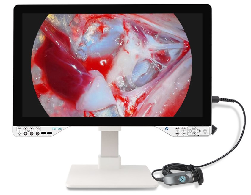 All In One Surgical Endoscope